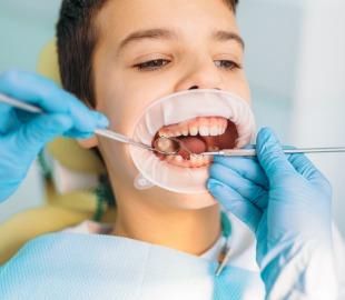 Criança em cadeira de dentista com afastador bucal, enquanto um dentista com luvas azuis usa um espelho e sonda para examinar os dentes, ilustrando o tratamento e prevenção de cáries em odontologia.